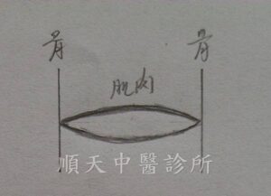 肌肉長度正常