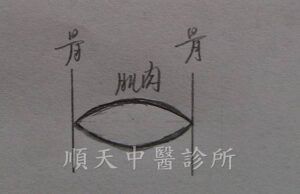 肌肉長度太短
